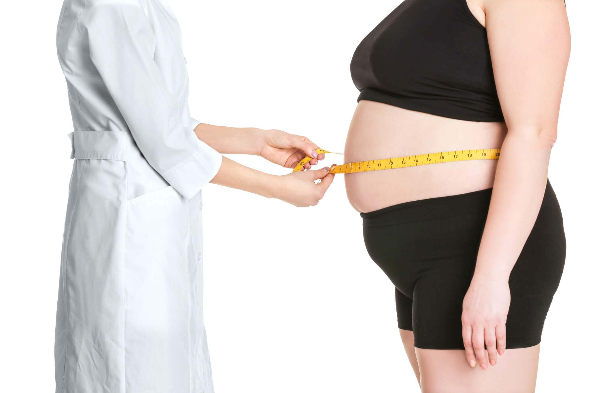 Liposuction and its Effects on Diabetes