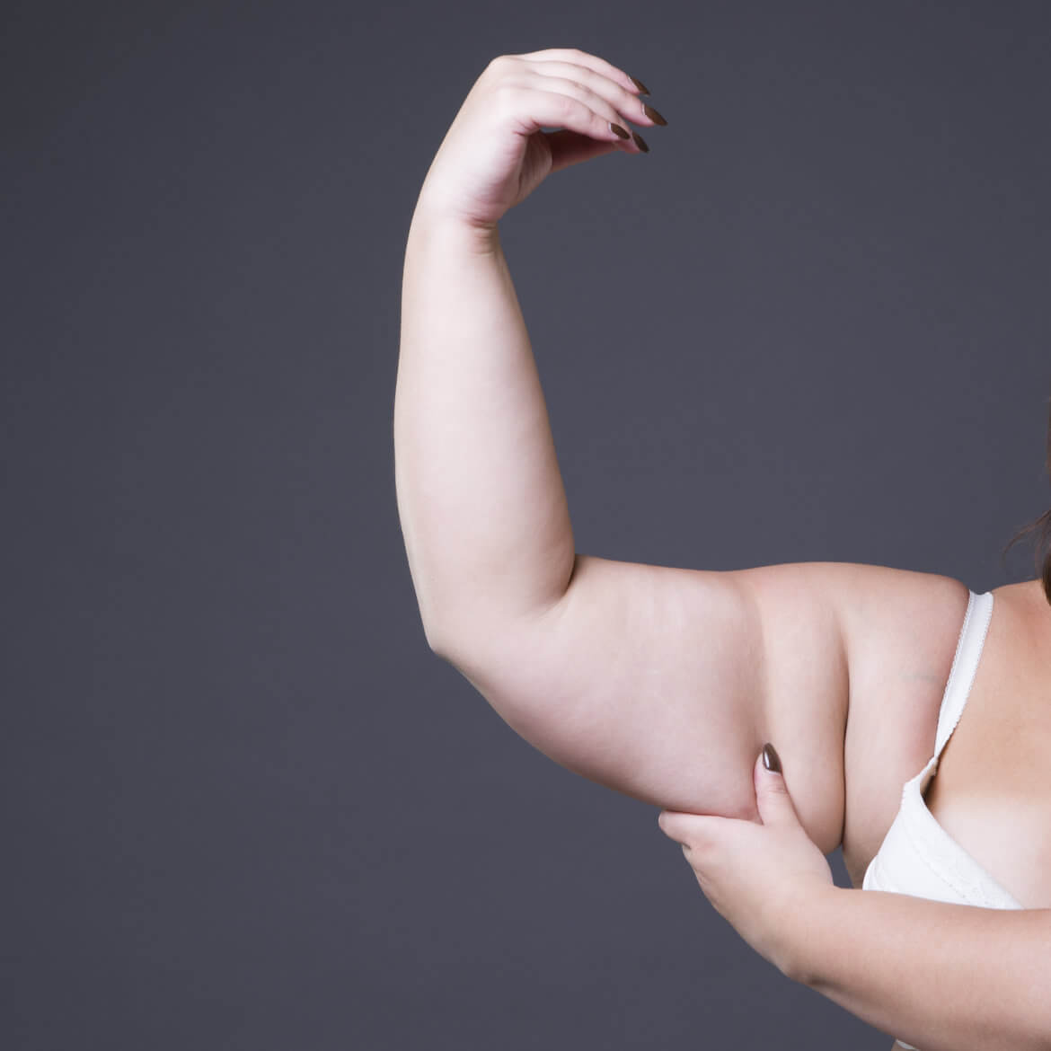 Liposuction vs CoolSculpting for the Arms